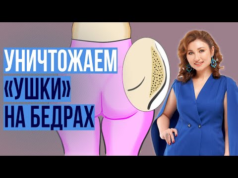 Видео: «Попины уши» - Как убрать навсегда. Как похудеть с помощью психологии