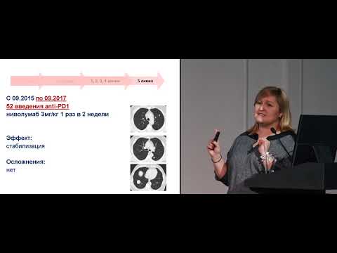 Видео: Меланома. Клинический случай