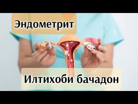 Видео: Что вызывает эндометрит? (воспаление матки) #эндометрит #здороваяжизнь #матка
