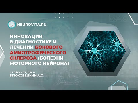 Видео: Инновации в диагностике и лечении бокового амиотрофического склероза(болезни моторного нейрона)