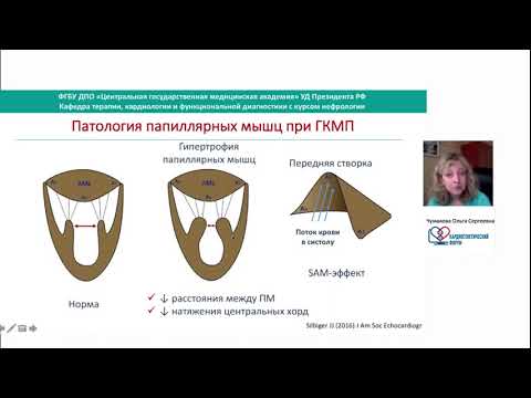 Видео: О С Чумакова Патофизиология ГКМП Лекция