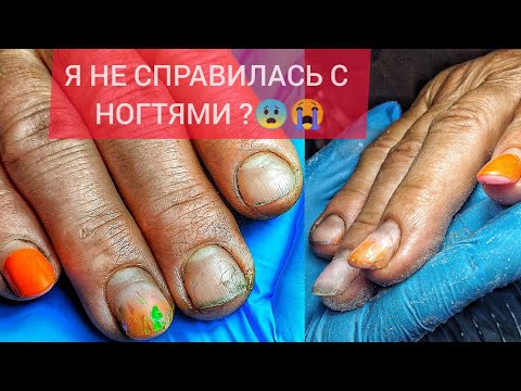 Видео: КЛИЕНТКА УШЛА😡😭И ВЕРНУЛАСЬ СПУСТЯ 2.5 МЕСЯЦА 🤯 ПРЕОБРАЖЕНИЕ НОГТЕЙ😍