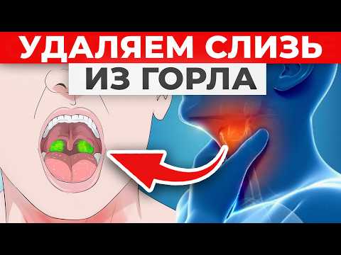 Видео: Вот как быстро избавиться от слизи в горле в домашних условиях!