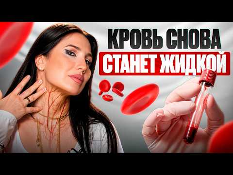 Видео: Как сделать КРОВЬ ЖИДКОЙ и избежать инфаркта? Врачи не расскажут!