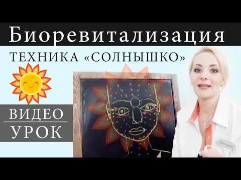 Видео: Техника биоревитализации "Солнышко"