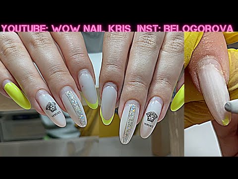 Видео: Хочу КАЛЯ-МАЛЯ Голубенькое! Как бороться с отслойками??