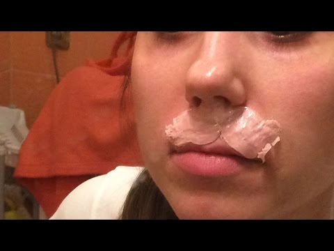 Видео: Депиляция на лице воском. Депиляция усиков.