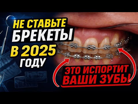 Видео: не ставьте такие брекеты в 2025 году