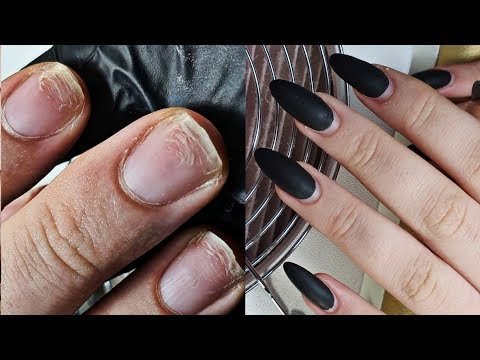 Видео: Так быстро ногти ещё не возвращались на коррекцию ..