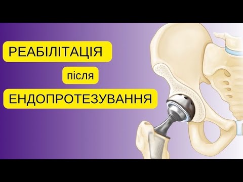 Видео: Відновлення після ендопротезування кульшового суглоба