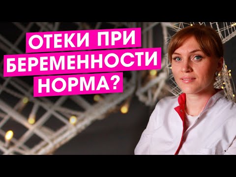 Видео: Отеки при беременности. Что делать? Это страшно? Правильная профилактика отеков. Как лечить. Видео.
