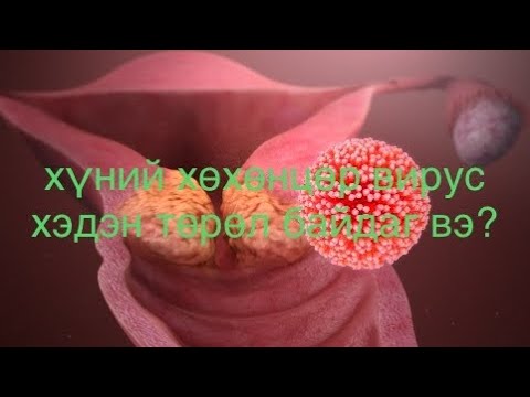 Видео: хүний хөхөнцөр вирусын төрлүүд