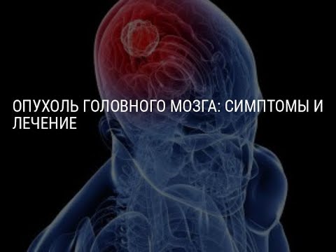 Видео: Симптомы рака мозга, Как я узнал что у меня рак мозга. Часть 1