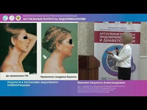 Видео: Иванова Л. А. Трудности в постановке эндогенного гиперкортицизма