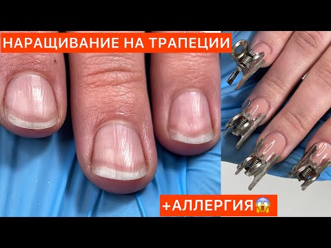 Видео: АЛЛЕРГИЯ НА ГЕЛЬ-ЛАК😱НАРАЩИВАНИЕ ТРАПЕЦИИ😤