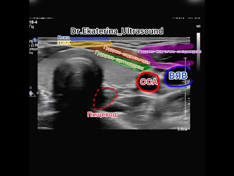 Видео: Мастер класс по ультразвуковому исследованию щитовидной железы