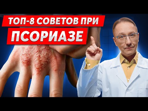 Видео: Как избавиться от псориаза за 1 месяц? Используй эти 8 советов!