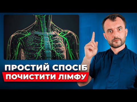 Видео: Як правильно і швидко ПОЧИСТИТИ ЛІМФУ БЕЗ ЛІКАРІВ! Як позбутися набряків
