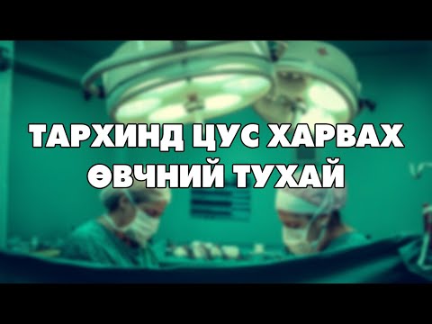 Видео: ТАРХИНД ЦУС ХАРВАХ ӨВЧНИЙ ТУХАЙ