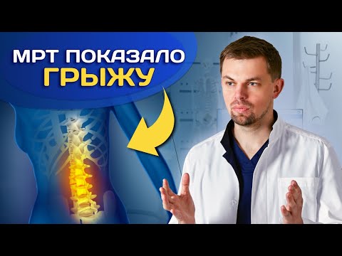 Видео: Как жить, если на МРТ — грыжа? Без паники....