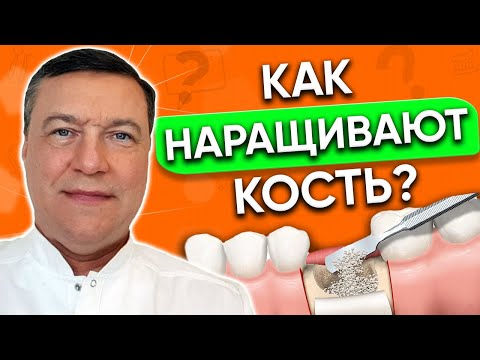 Видео: Наращивание костной ткани для ИМПЛАНТАЦИИ зубов