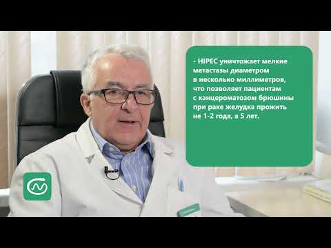 Видео: Энциклопедия пациента. Место HIPEC в абдоминальной онкологии