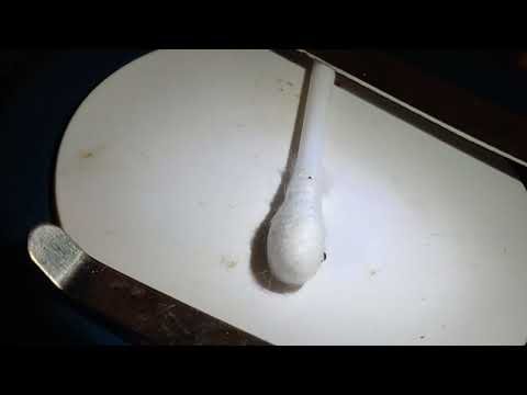 Видео: Клещи у Кенара/канарейки  в микроскоп/ Tracheal Ticks of the Canary under microscope