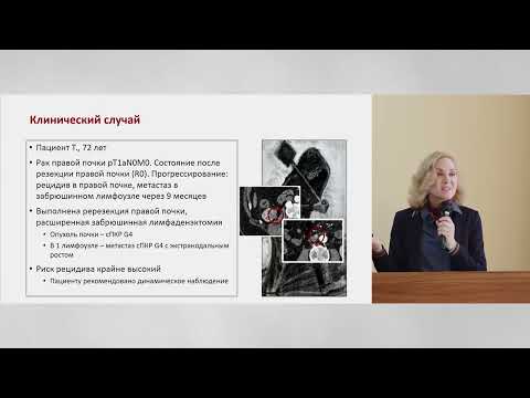 Видео: Онкоурология. Результаты исследований 2022 года, или что я изменил бы в лечении конкретного пациента