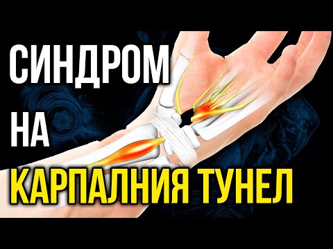 Видео: Синдром на КАРПАЛНИЯ ТУНЕЛ - 7 упражнения за облекчаване на болката и заздрaвяване