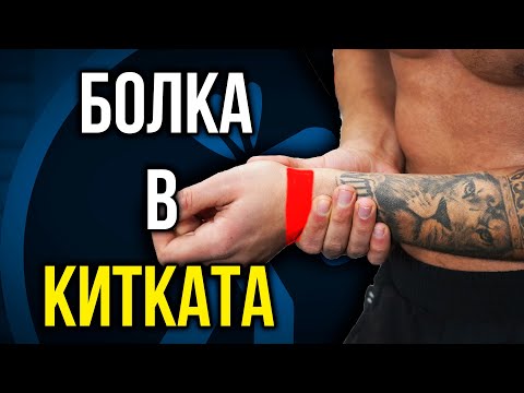 Видео: 3 упражения при БОЛКА В КИТКАТА - При възпаление