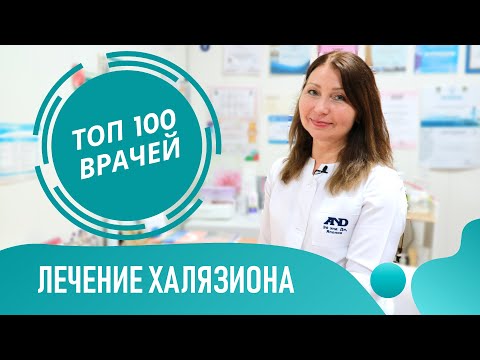 Видео: Лечение Халязиона глаза: капли и мазь. Как избавиться от халязиона. Воспаление века