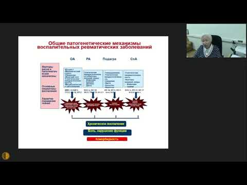 Видео: Остеоартрит суставов кистей: современное состояние проблемы 20.01.2021