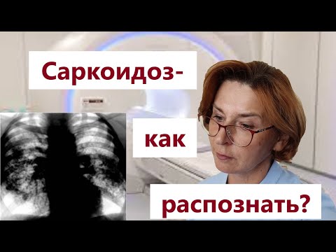 Видео: Саркоидоз, диагностика