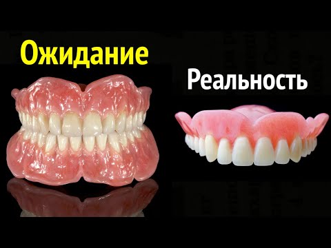 Видео: ПРИМЕРКА - этап, где ВСЁ решается!) ............ #съёмныепротезы #протезированиезубов #стоматология