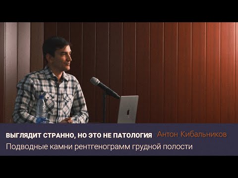Видео: Выглядит странно, но это не патология
