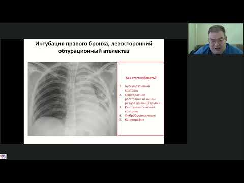 Видео: Осложнения ИВЛ Афончиков В.С.