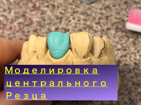 Видео: Моделировка зубов из воска  Моделирование центрального резца  Форма зуба, резец
