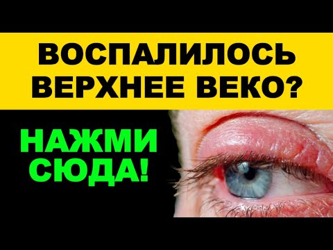 Видео: Снять отёк и тяжесть в глазах | Массаж и акупунктура