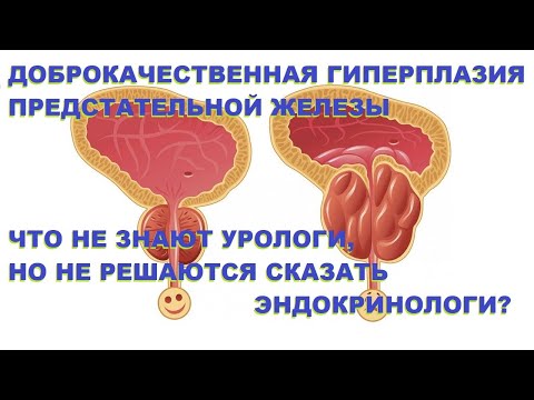 Видео: ДГПЖ: что не знают урологи, но не решаются предложить эндокринологи?