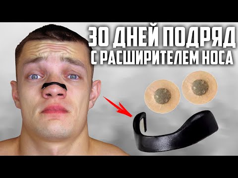 Видео: 30 ДНЕЙ ПОДРЯД НОСИЛ РАСШИРИТЕЛЬ ДЛЯ НОСА, ВОТ ЧТО ВЫШЛО!