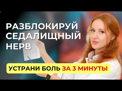 Видео: Защемило седалищный нерв? Упражнение, чтобы снять боль