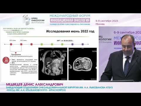 Видео: Хирургическое лечение забрюшинных сарком. Опыт региона_Медведев Д.А