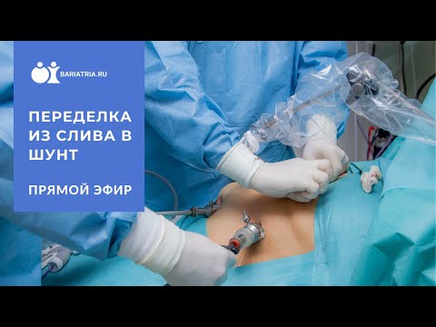 Видео: Реконструкция из гастропластики в шунтирование желудка
