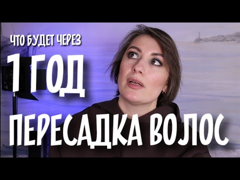 Видео: ПЕРЕСАДКА ВОЛОС результат ЧЕРЕЗ 1 ГОД| пересадка до и после| как лечить алопецию?| сколько стоит