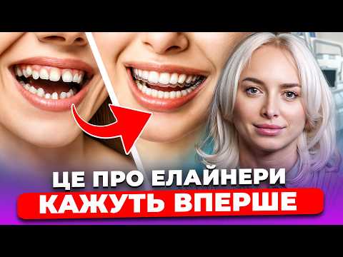 Видео: ВІД ЕЛАЙНЕРІВ БОЛЯТЬ ЗУБИ?! Як насправді працюють КАПИ? ЩО краще: БРЕКЕТИ чи ЕЛАЙНЕРИ?