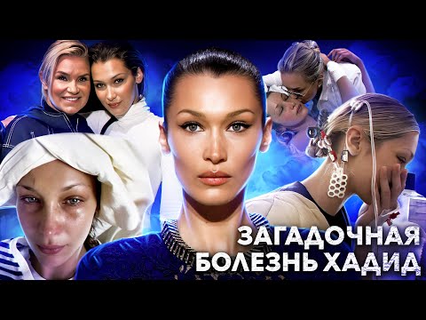 Видео: ТАЙНА БЕЛЛЫ ХАДИД: так ли реальна болезнь Лайма семейства Хадид? поклонники бьют тревогу...