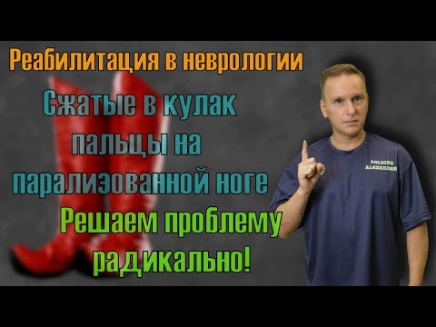 Видео: Зажатые в кулак пальцы на парализованной ноге. Решаем проблему радикально.