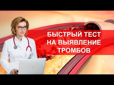 Видео: Быстрый тест на выявление тромбов