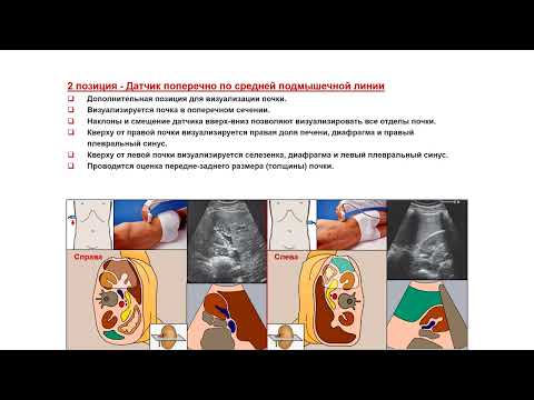 Видео: Ультразвуковая диагностика (УЗИ). Доктор Иогансен. Выпуск 68. Методика УЗИ почек.