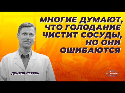 Видео: Многие думают, что голодание чистит сосуды, но они ошибаются.